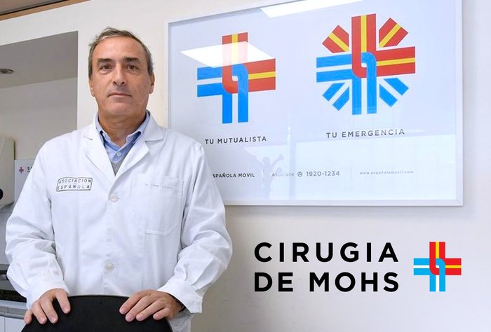 Cirugía de Mohs en la Asociación Española